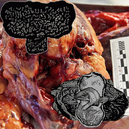 Blunted Torso : Carcinoma Basocelular - Blunted Torso Blunted Torso : Carcinoma Basocelular - Blunted Torso